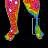 Pain Evaluation thermographic image