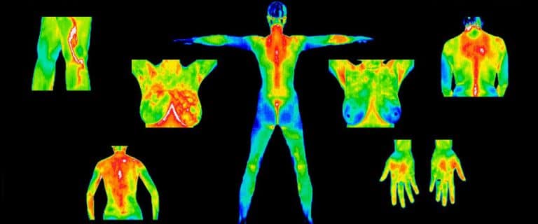 Thermography - Thermographic Diagnostic Imaging