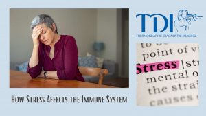 Stress affects the immune system