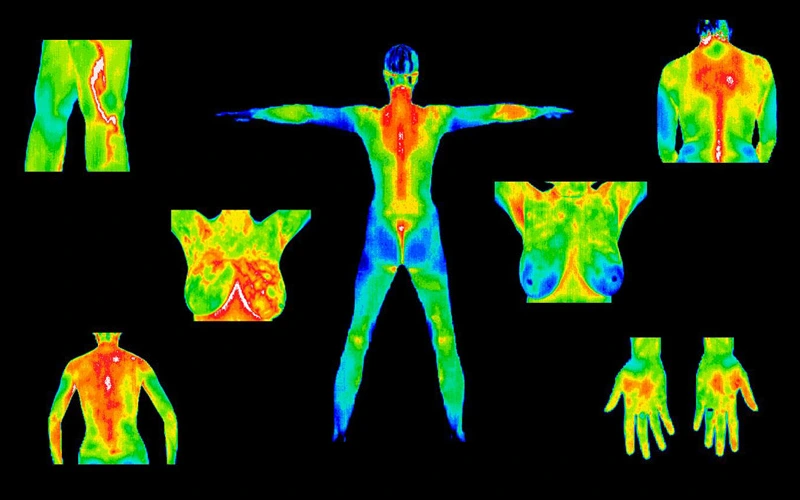 Medical Thermography images