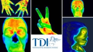 A Safe and Comprehensive Diagnostic Tool - Thermography