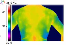 Upper body thermography shows possible Fibromyalgia